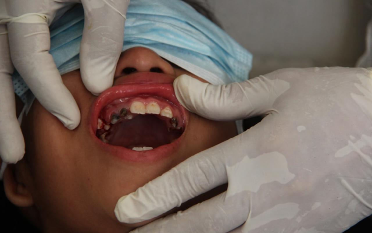 Importanța Igienei Dentare Zilnice